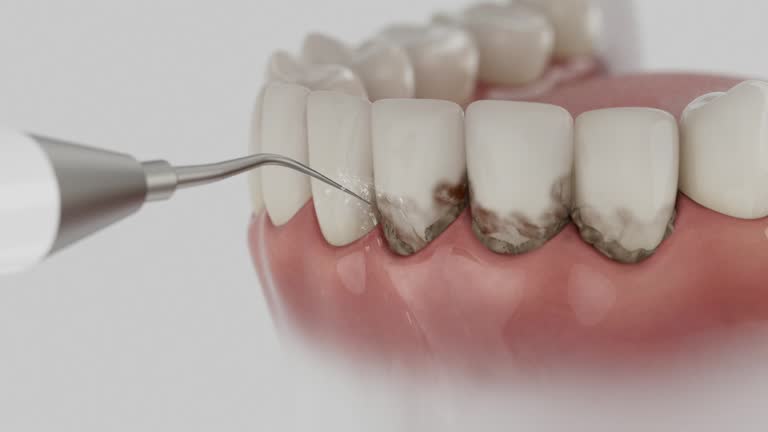 Reliable Dental contractor in Chadron, NE by Dentist Open Now